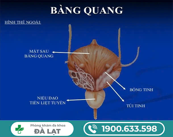 BIẾN CHỨNG VIÊM BÀNG QUANG