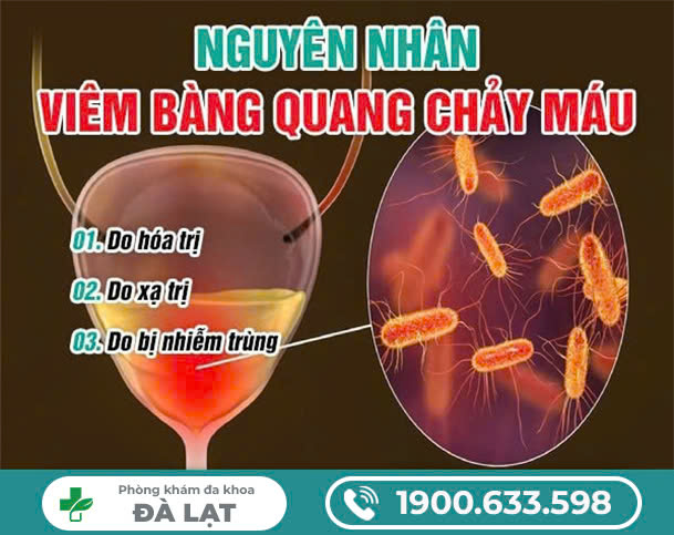 VIÊM BÀNG QUANG CHẢY MÁU