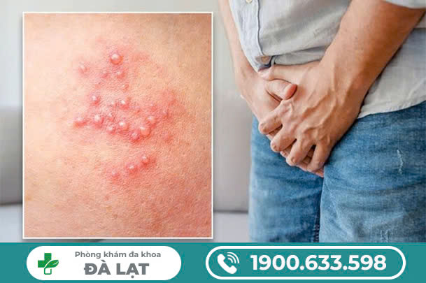 NGỨA DƯƠNG VẬT - DẤU HIỆU MÀ NAM GIỚI KHÔNG ĐƯỢC CHỦ QUAN