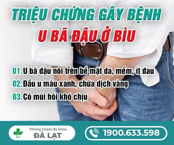 U BÃ ĐẬU Ở BÌU