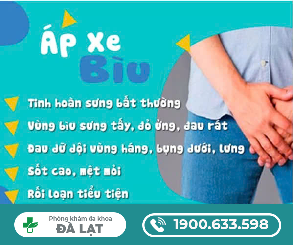 ÁP XE BÌU LÀ GÌ?