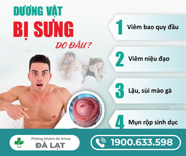 SƯNG ĐAU DƯƠNG VẬT NAM GIỚI MẮC BỆNH GÌ
