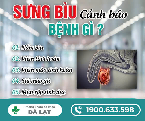 SƯNG BÌU BÁO HIỆU BỆNH GÌ?