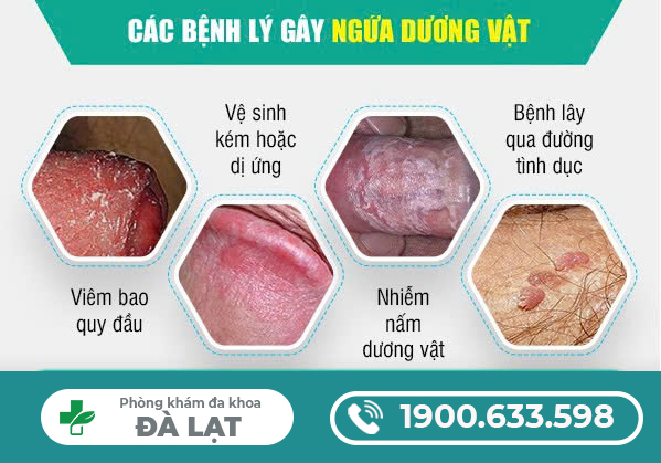 NGUYÊN NHÂN BỊ NGỨA DƯƠNG VẬT