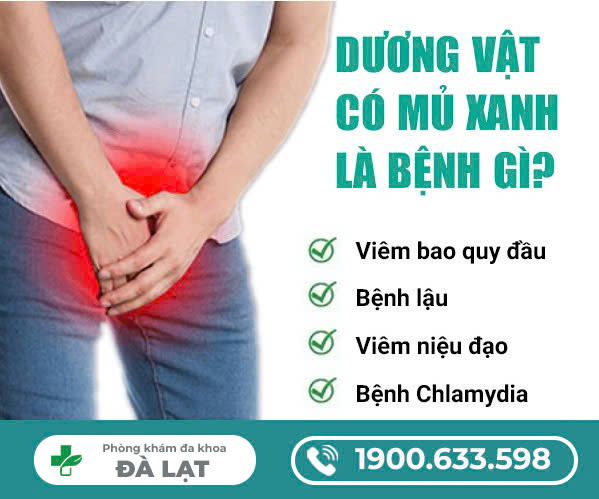 DƯƠNG VẬT CHẢY MỦ XANH