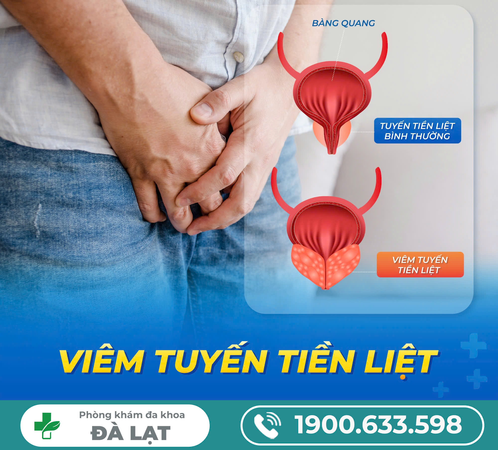 TÌM HIỂU VỀ VIÊM TUYẾN TIỀN LIỆT Ở NAM GIỚI