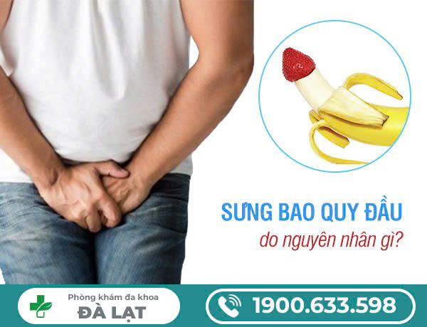 SƯNG BAO QUY ĐẦU: NHỮNG THÔNG TIN CẦN BIẾT