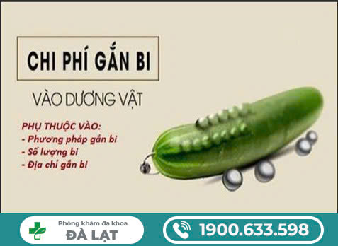 CHI PHÍ GẮN BI BAO NHIÊU