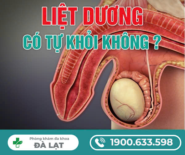 LIỆT DƯƠNG CÓ TỰ KHỎI KHÔNG
