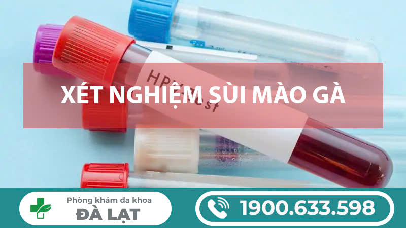 Địa chỉ uy tín để xét nghiệm sùi mào gà 
