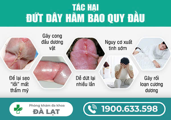 BỊ ĐỨT DÂY CHẰNG DƯƠNG VẬT Ở NAM GIỚI
