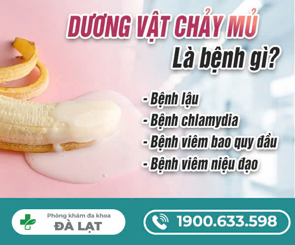 DƯƠNG VẬT CHẢY MỦ LÀ BỆNH GÌ