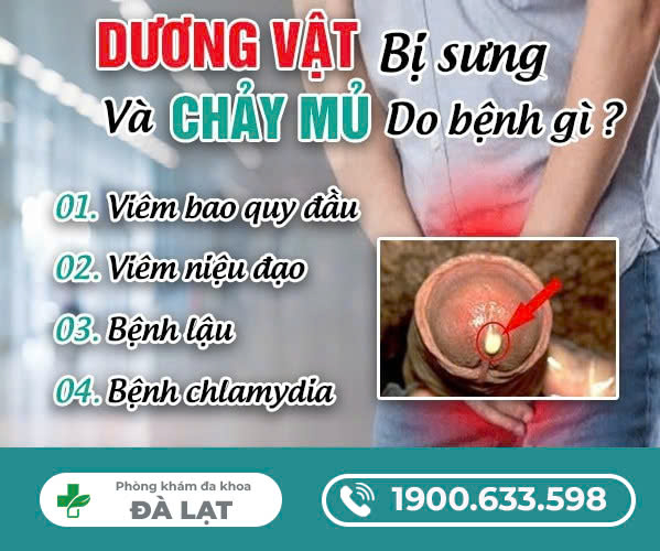 DƯƠNG VẬT BỊ SƯNG VÀ CHẢY MỦ: NGUYÊN NHÂN VÀ CÁCH CHỮA