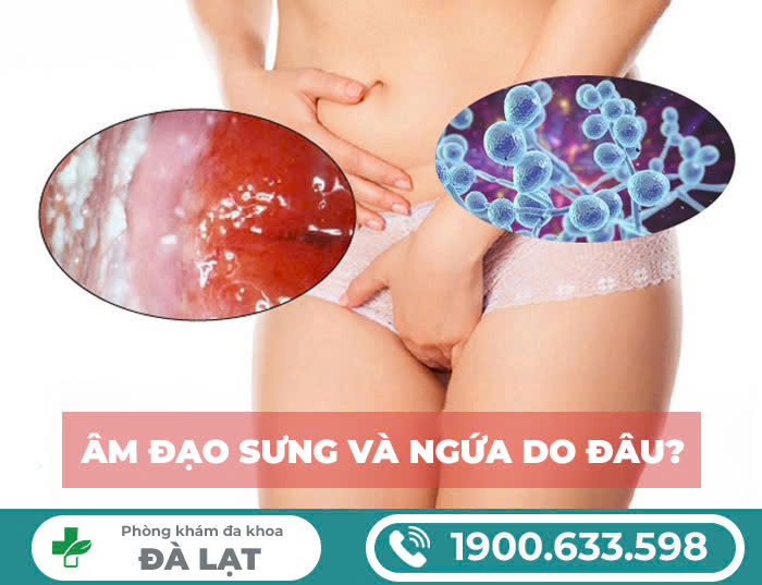 Mẩn Đỏ Vùng Kín Nữ – Nguyên Nhân, Cách Khắc Phục Tại Phòng Khám Đa Khoa Đà Lạt