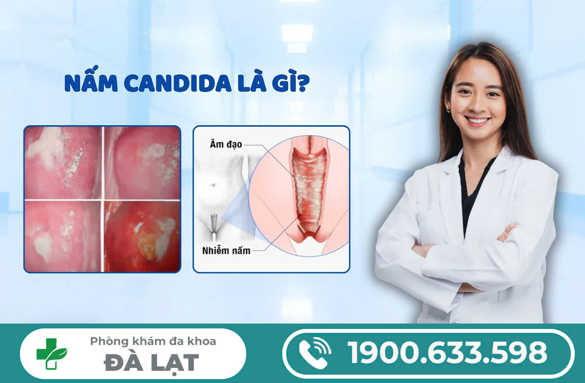 Nấm Candida - “Thủ phạm" gây bệnh phụ khoa và cách điều trị