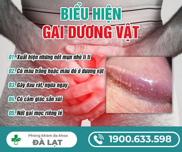 TÌM HIỂU GAI DƯƠNG VẬT LÀ GÌ
