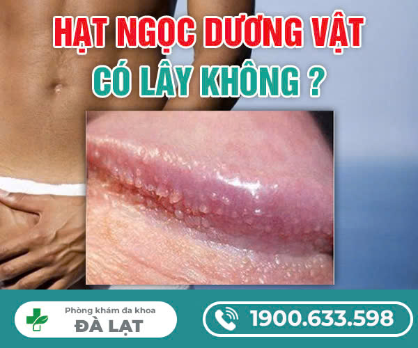 CHIA SẺ HẠT NGỌC DƯƠNG VẬT CÓ LÂY KHÔNG?