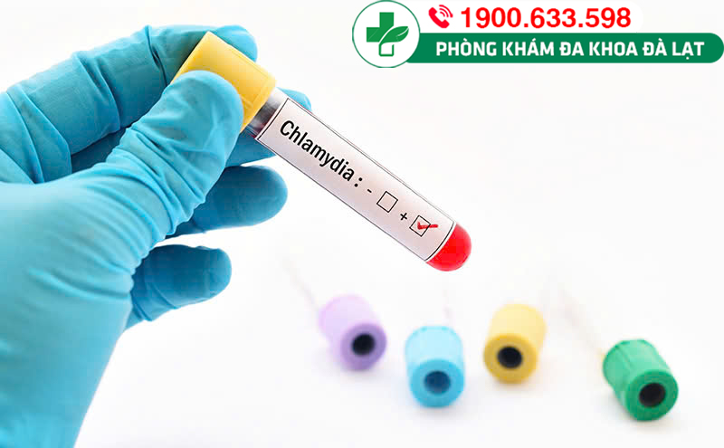 Xét nghiệm chẩn đoán bệnh Chlamydia