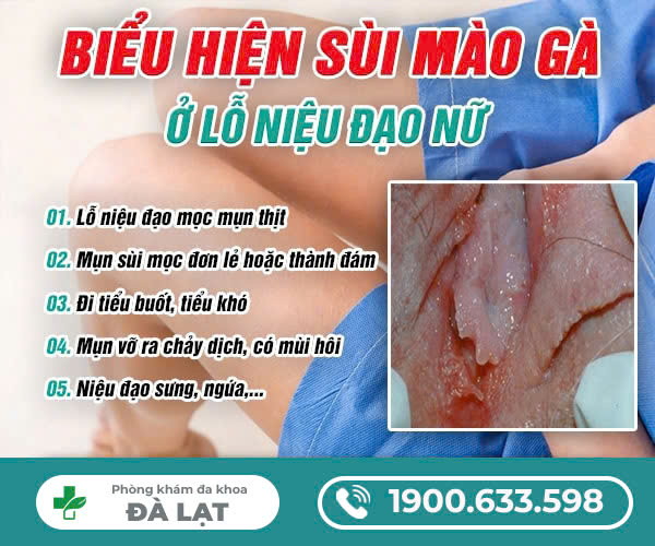 TÌM HIỂU VỀ BỆNH SÙI MÀO GÀ Ở LỖ NIỆU ĐẠO NỮ