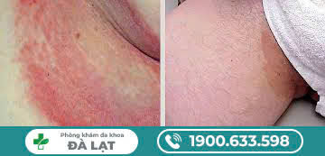 Block Image