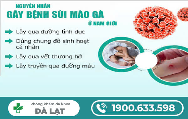 NGUYÊN NHÂN BỊ SÙI MÀO GÀ Ở NAM GIỚI