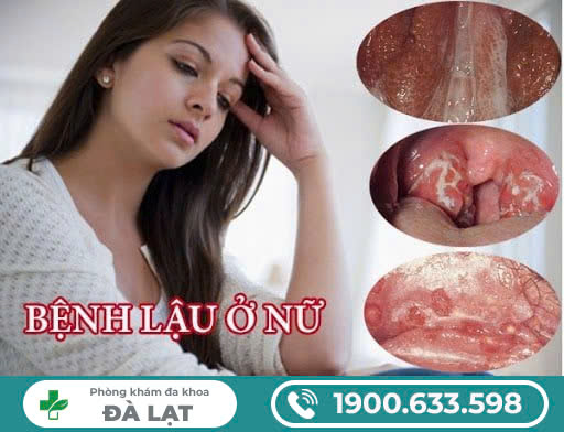           BỆNH LẬU Ở NỮ CÓ NGUY HIỂM KHÔNG