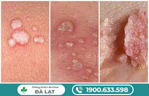 Block Image