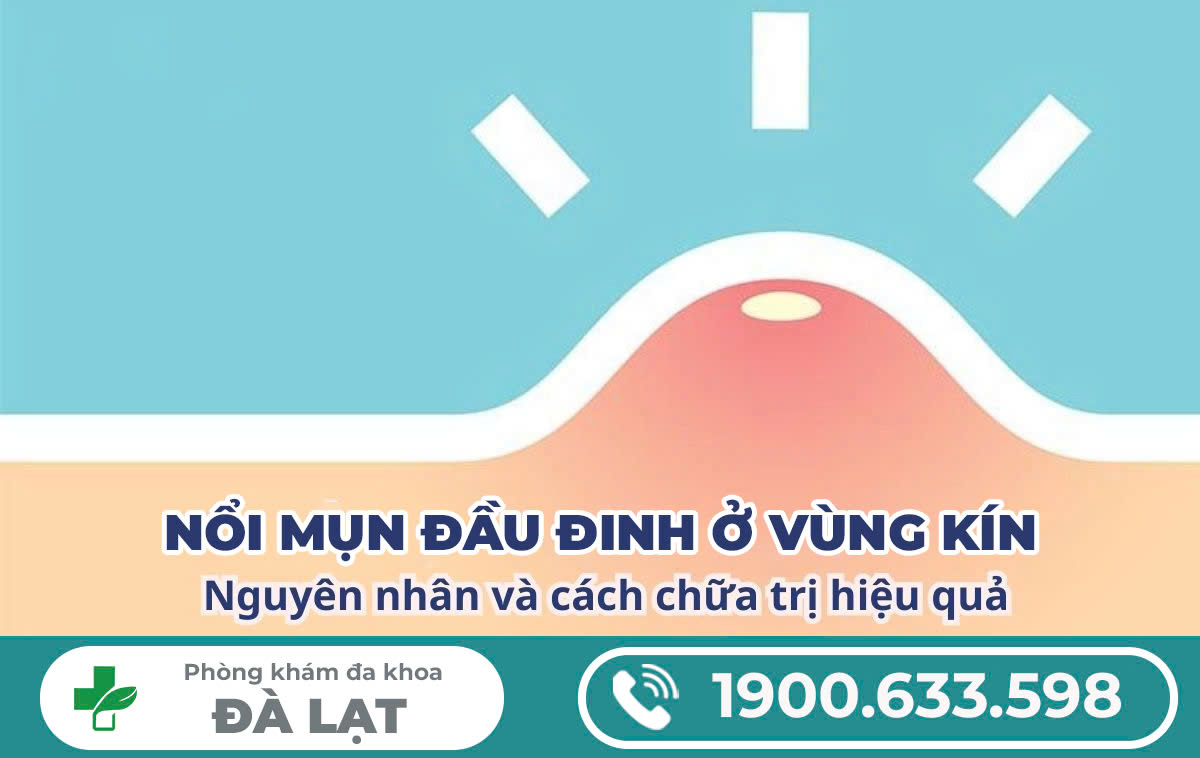 Mọc Mụn Đầu Đinh Ở Vùng Kín – Nguy Hiểm Như Thế Nào? Cách Điều Trị An Toàn