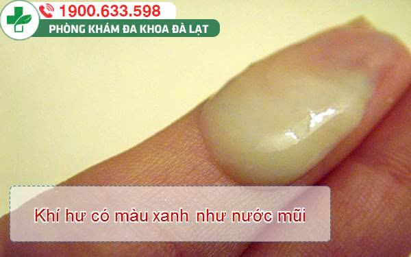 Block Image
