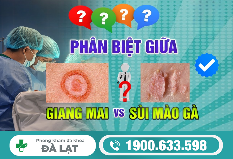 Phân Biệt Bệnh Giang Mai và Sùi mào Gà 