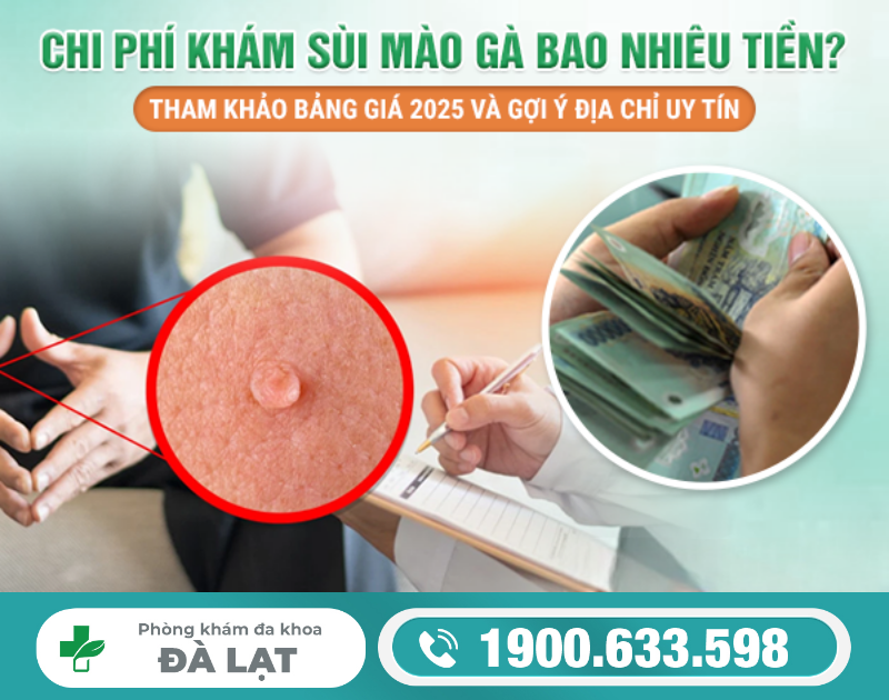 CHI PHÍ KHÁM CHỮA SÙI MÀO GÀ