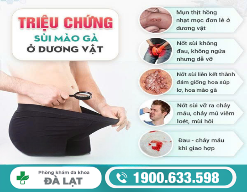 TÌM HIỂU BỆNH SÙI MÀO GÀ Ở DƯƠNG VẬT NAM GIỚI