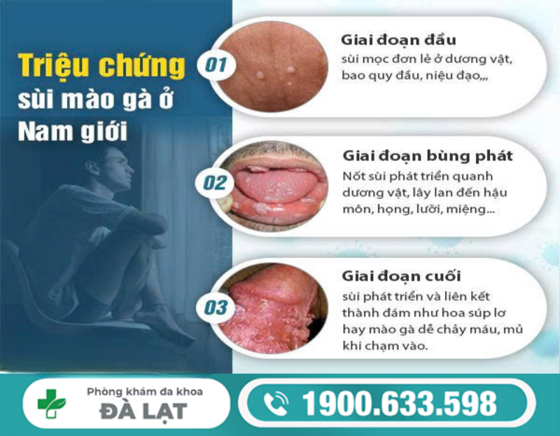 BỆNH SÙI MÀO GÀ Ở LỖ SÁO NAM GIỚI