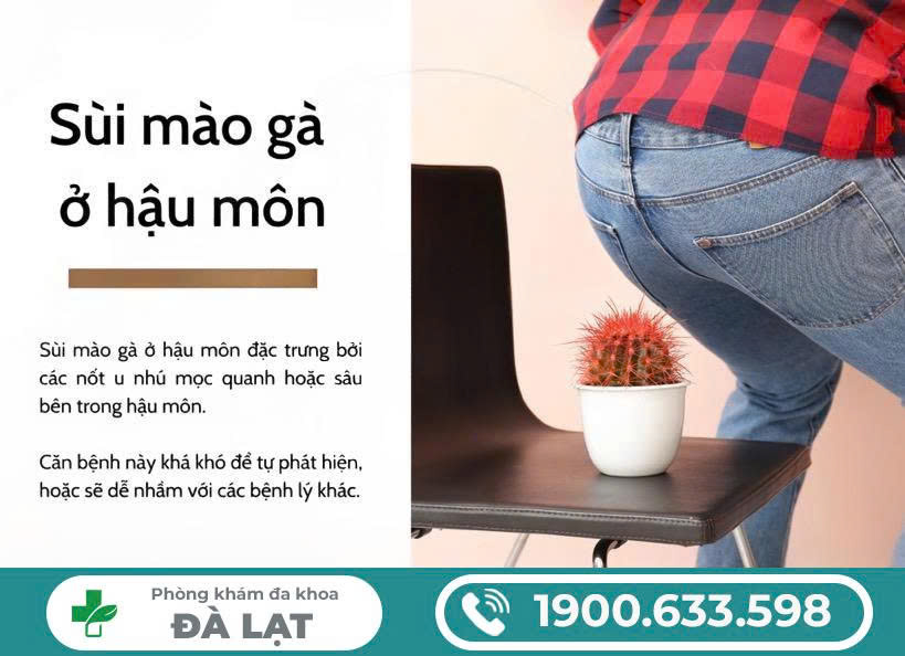 TÌM HIỂU BỆNH SÙI MÀO GÀ Ở HẬU MÔN NỮ 