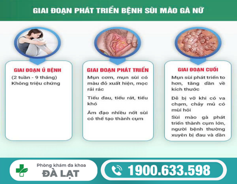 TÌM HIỂU BỆNH SÙI MÀO GÀ Ở VÙNG KÍN NỮ