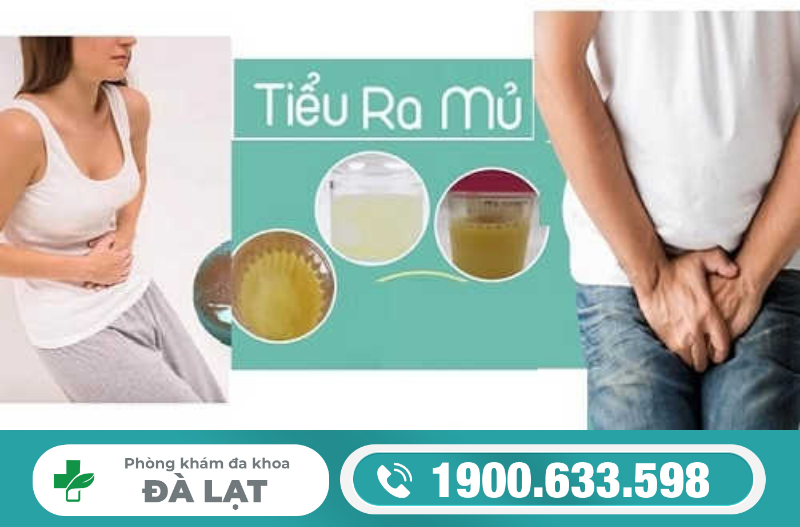 Hiện Tượng: Đi Tiểu Buốt Ra Mủ 