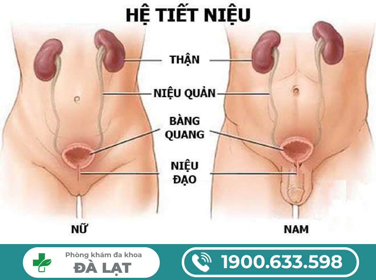 Viêm Đường Tiết Niệu Chảy Mủ Ở Nam và Nữ 