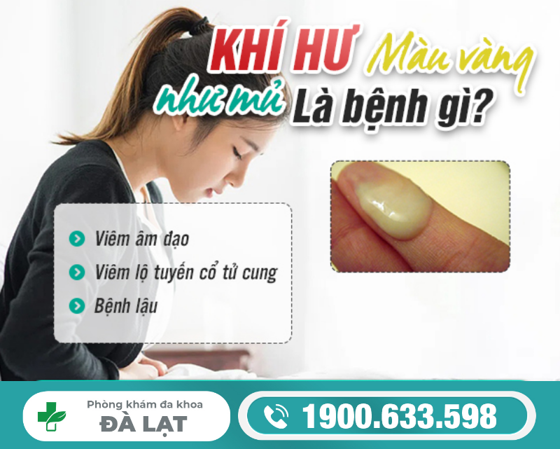 Khí Hư Màu Vàng Như Mủ Là Bệnh Gì? 