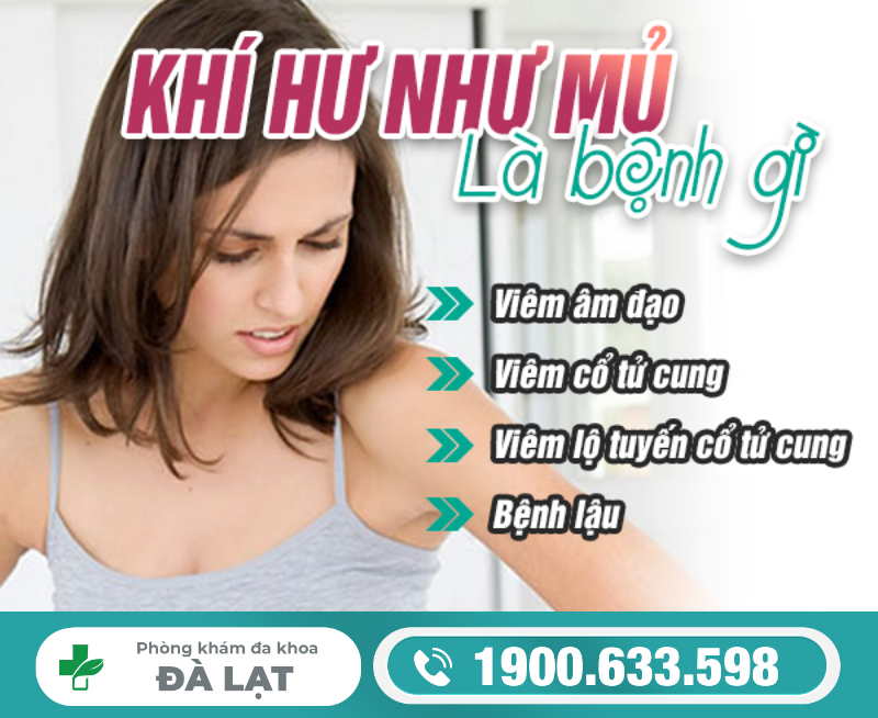 Khí Hư Như Mủ Là Gì? Nguyên Nhân và Cách Khắc Phục 