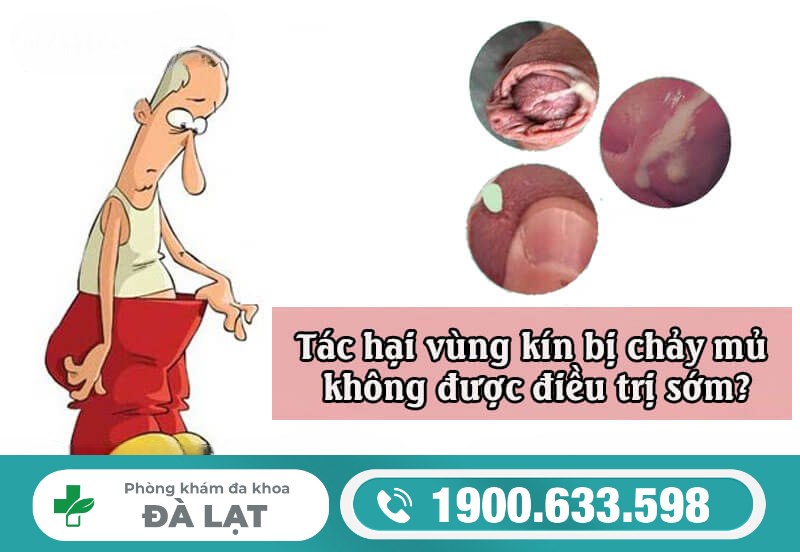 Vùng Kín Chảy Mủ Sau Quan Hệ 