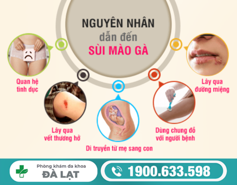 CÁC NGUYÊN NHÂN GÂY BỆNH SÙI MÀO GÀ Ở NỮ GIỚI 