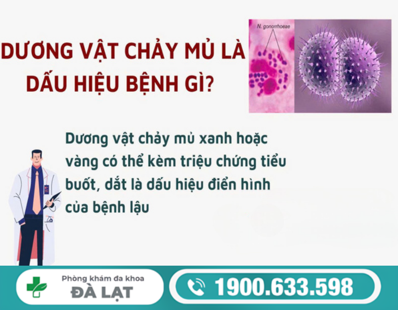 TÌM HIỂU VỀ DƯƠNG VẬT CÓ MỦ VÀNG