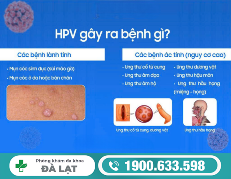 GIẢI ĐÁP: HPV CÓ NGUY HIỂM KHÔNG?