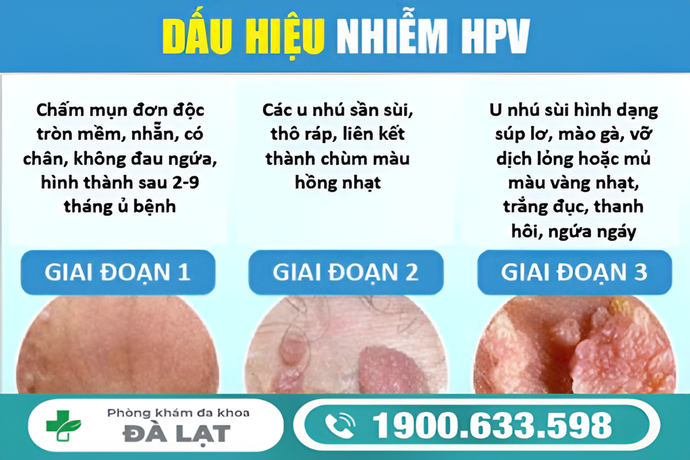 TÌM HIỂU CÁC DẤU HIỆU BỊ NHIỄM HPV THƯỜNG GẶP