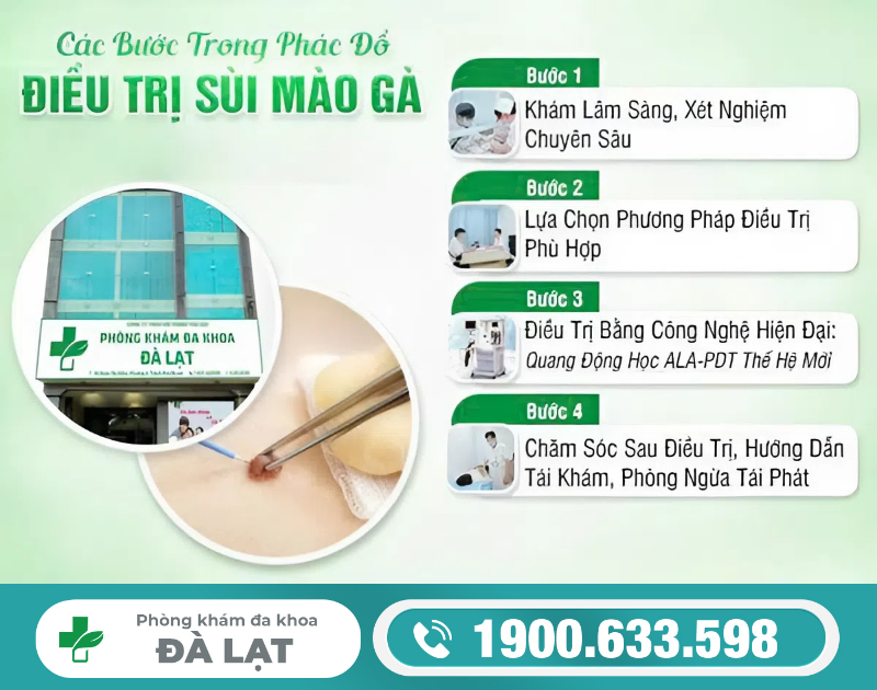 PHÁC ĐỒ ĐIỀU TRỊ SÙI MÀO GÀ HIỆU QUẢ VÀ TIẾT KIỆM CHI PHÍ