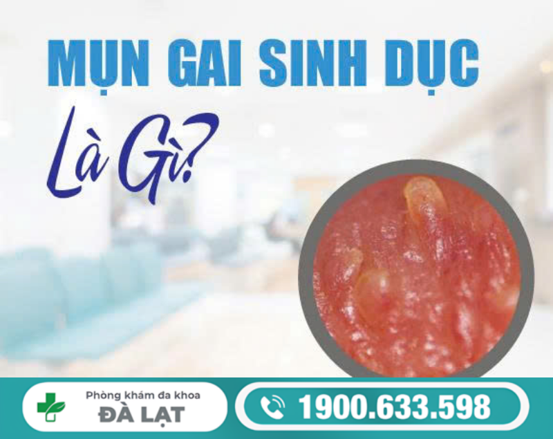 MỤN GAI SINH DỤC Ở NAM VÀ NỮ: NGUYÊN NHÂN VÀ CÁCH ĐIỀU TRỊ HIỆU QUẢ