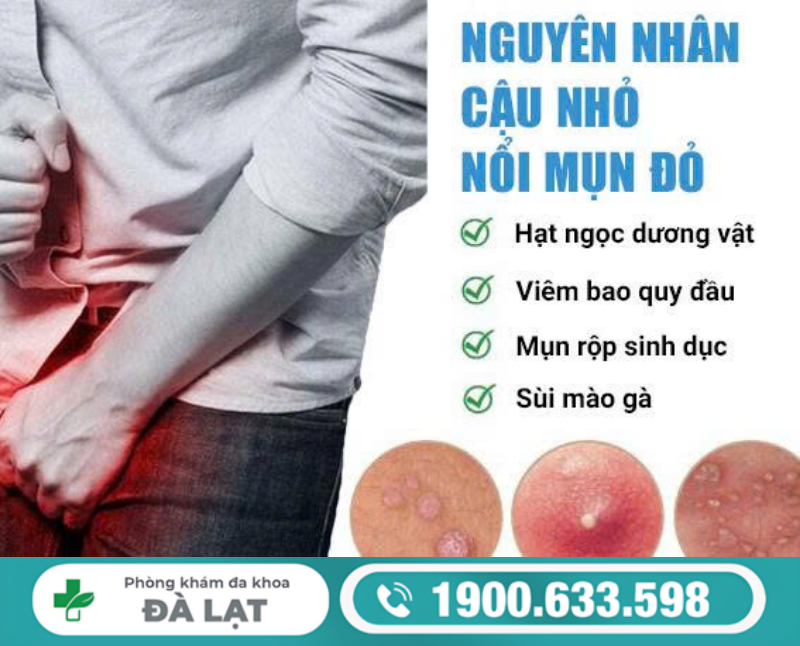 TÌM HIỂU DƯƠNG VẬT CÓ NỐT ĐỎ VÀ CÁCH ĐIỀU TRỊ 