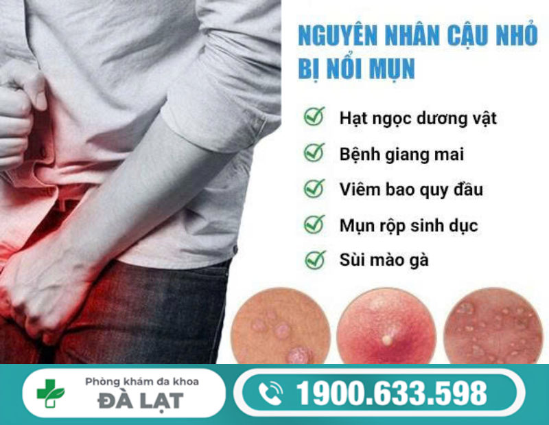 TÌM HIỂU NỔI NỐT Ở BAO QUY ĐẦU VÀ CÁCH ĐIỀU TRỊ