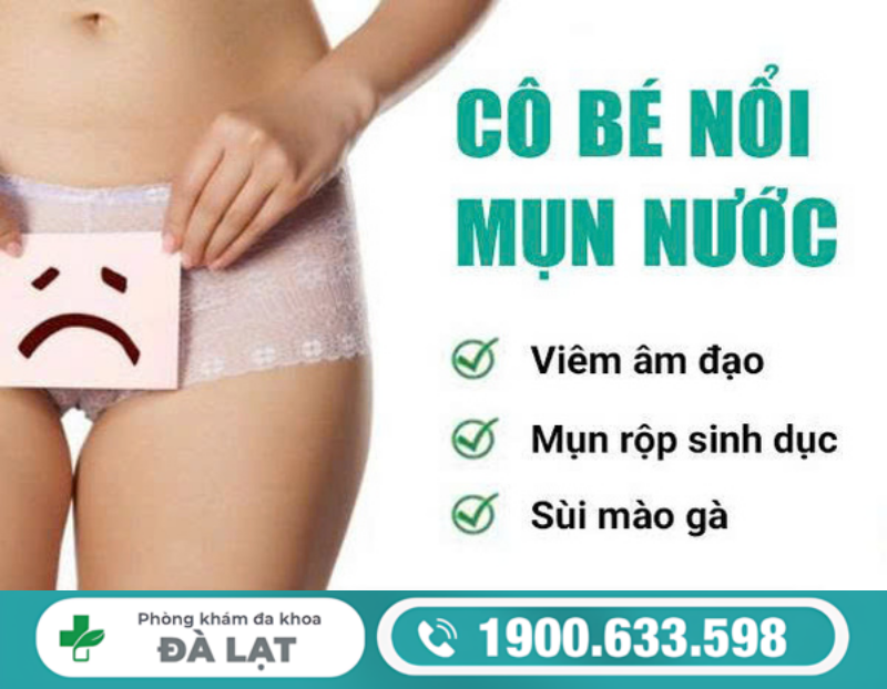 MỌC MỤN NƯỚC Ở VÙNG KÍN NỮ VÀ CÁCH ĐIỀU TRỊ 