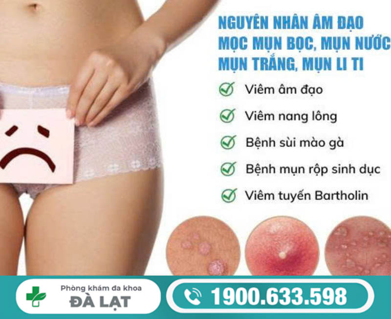 MỌC MỤN BỌC Ở VÙNG KÍN NỮ: NGUYÊN NHÂN VÀ CÁCH ĐIỀU TRỊ 